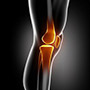 Lateral Approach Total Knee Replacements